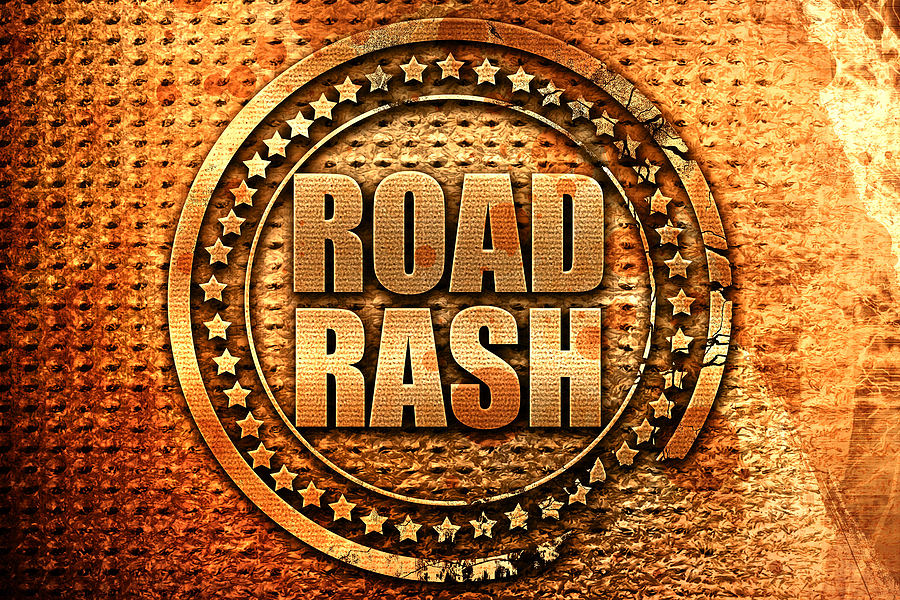 What Can I Do When Another Driver’s Carelessness Leaves Me With A Road Rash?